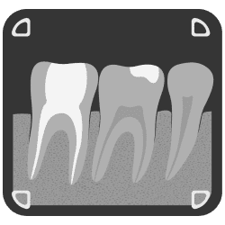 Dental Diagnosis