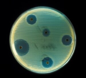 صورة الموضوع المميزة: Staphylococcus aureus AB Test