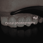 صورة الموضوع المميزة: Dental photography 1