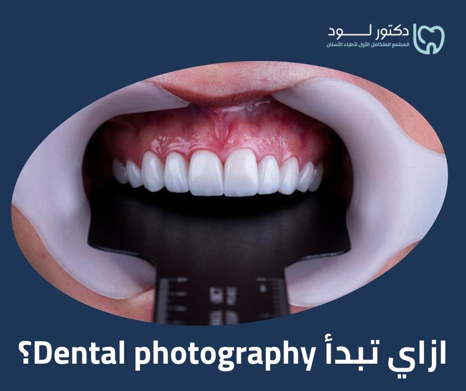 ازاي تبدأ Dental photography