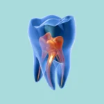 The Digital Twin in Root Canal Treatment: From Sci-Fi to the Clinic